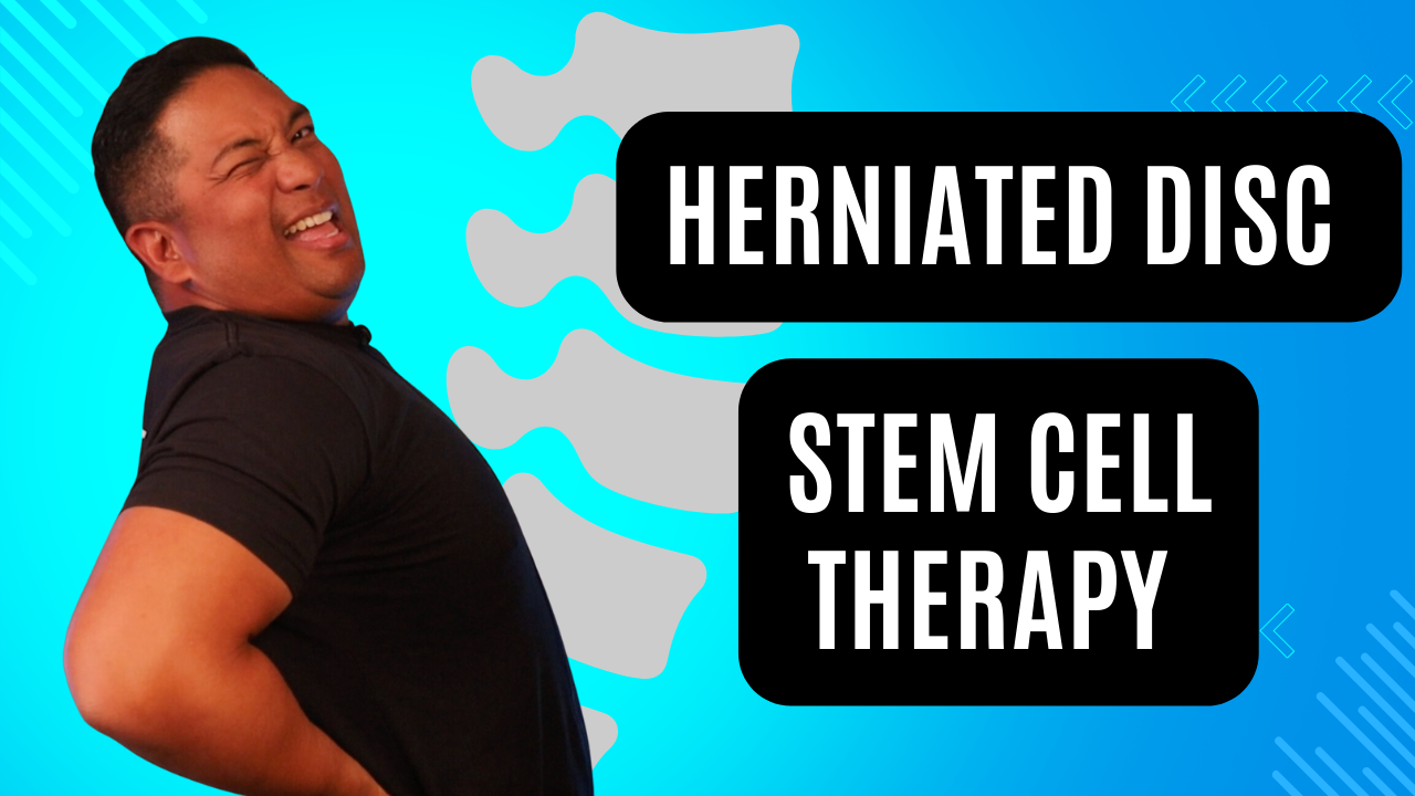 Can I Do Stem Cell Therapy for a Herniated Disc? - Stem Cell Recovery ...